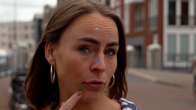 Kom je met deze vrolijke stickers af van je puistjes? Gen Z gelooft er heilig in