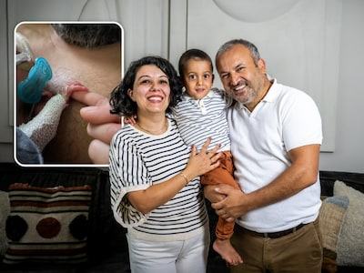 Miran (2) overleefde een extreme vroeggeboorte, maar de impact is elke dag voelbaar