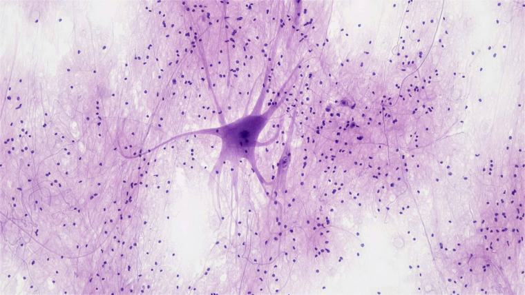 Nanodeeltjes maken nieuwe neuronen in het brein van muizen met alzheimer